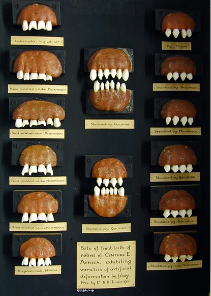Shaped Teeth from Mozambique, Malawi and Tanzania, before 1910