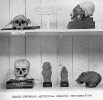 Series showing Artificial Cranial Deformation (Plate XVIII, 'The Pitt-Rivers Museum, Farnham')