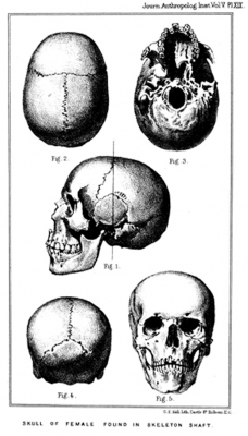 Cissbury illustration