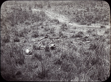 Dinka skeletal remains