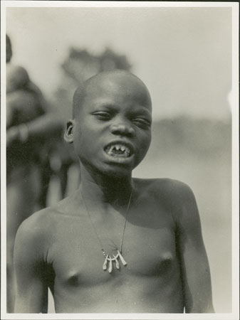 Moro girl showing teeth mutilation